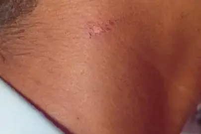 Minderjarige broers beschuldigen agenten van mishandeling op politiepost Meerzorg